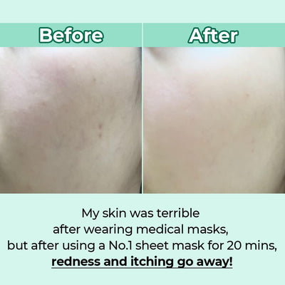 No.1 Dewy Glow Spa Sheet Mask 4Ea / Boîte | Apaiser Et Détendre, Peau Rosée Et Hydratée